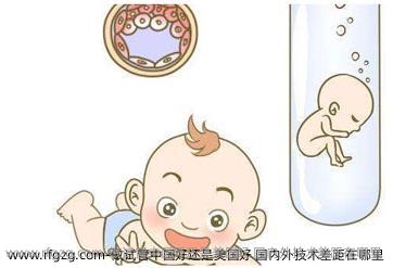 做试管国内好还是美国好 国内外技术差距在哪里